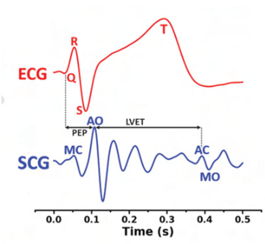 ECG SCG tatuaggio monitoraggio parametri cuore
