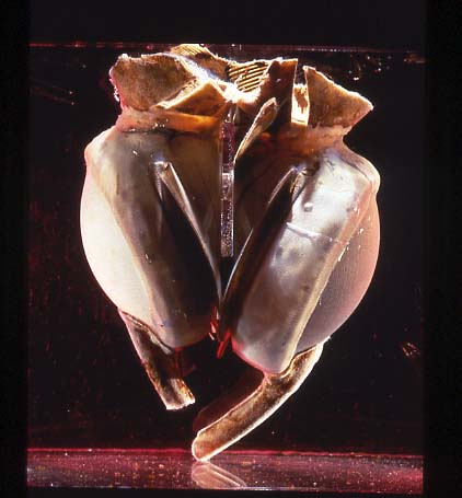 Il primo cuore artificiale totale di Liotta-Cooley del 1969, con i due ventricoli artificiali in materiale sintetico