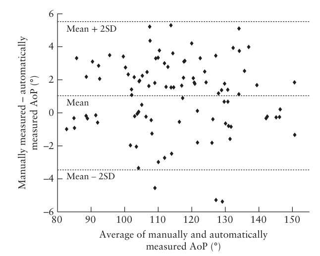Diagramma di Bland-Altman che mostra l'accordo tra AoP misurato manualmente e automaticamente, con la maggior parte dei punti entro i limiti ±2SD