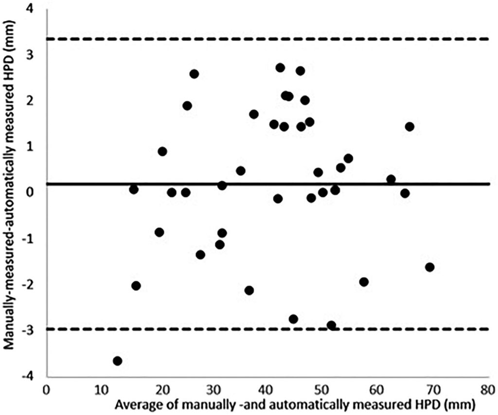 Diagramma di Bland-Altman HPD: differenze tra misura manuale e automatica distribuite entro i limiti di concordanza del 95% (±3 mm), con bias medio prossimo a zero