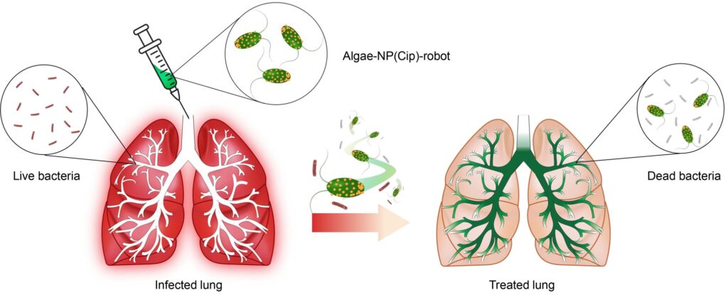 Schema che mostra la trasformazione da polmone infetto con batteri vivi a polmone trattato con batteri morti, dopo somministrazione di microbot alghe-NP(Cip) tramite iniezione