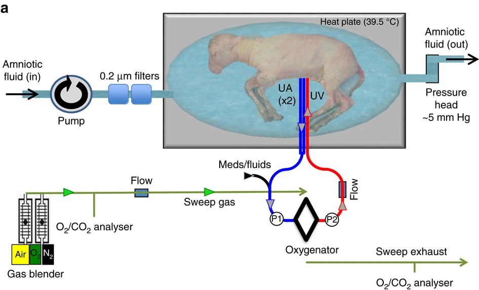 Diagramma del sistema EXTEND: feto di agnello in sacca di liquido collegata a ossigenatore e miscelatore di gas