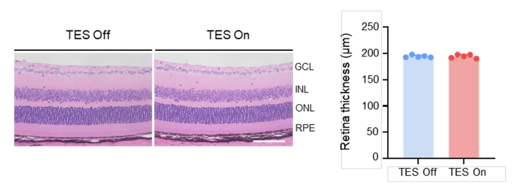 Immagini istologiche della retina e grafico dello spessore retinico: nessuna differenza tra i gruppi TES On e TES Off (circa 195 μm in entrambi)